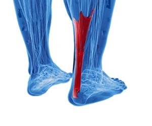 Achilles Tendon Injuries on the Rise