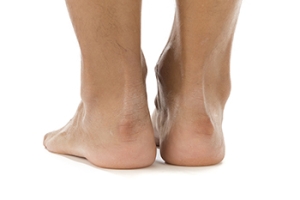 High Heels and Haglund’s Deformity: Why Shoe Choice Matters