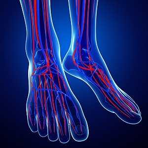 Why Do I Have Poor Circulation?