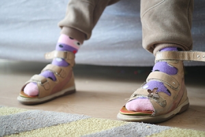 Orthotics and Children With Flexible Flatfoot