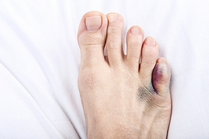 Pinky Toe Pain While Walking