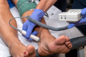 What is Buerger’s Disease?